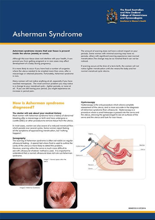 Asherman Syndrome