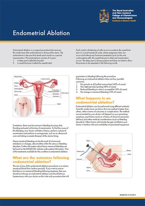 endometrial ablation