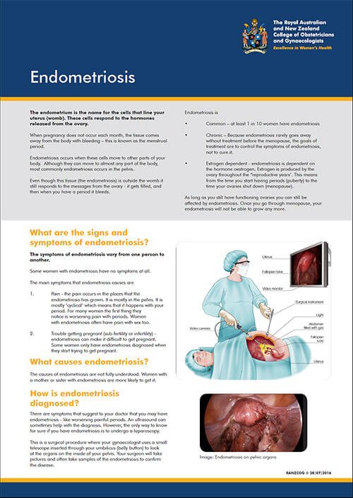 endometriosis