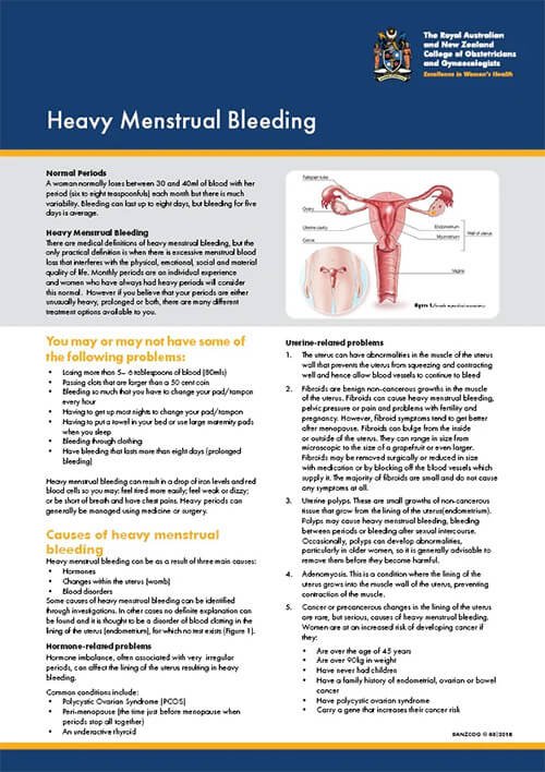 heavy menstrual bleeding