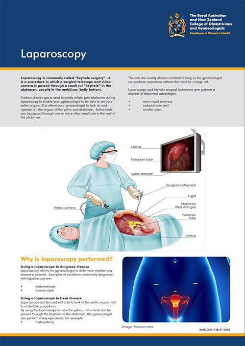 laparoscopy